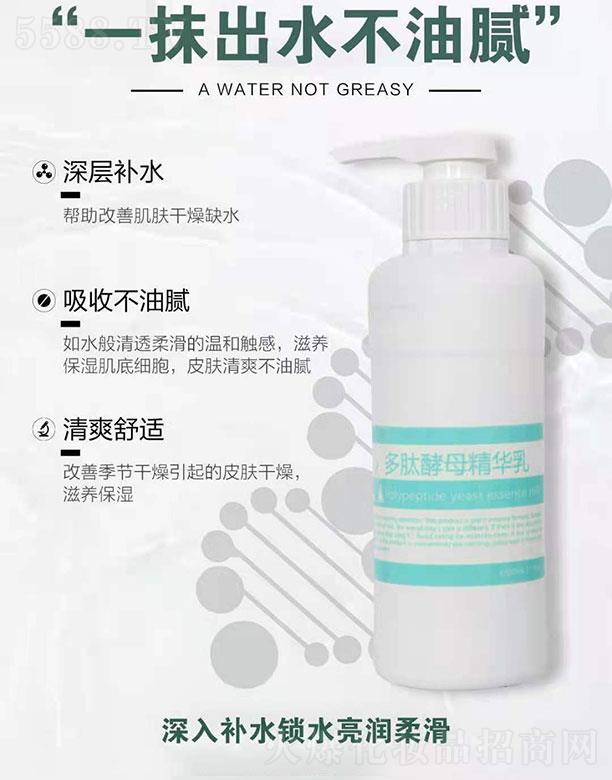 ���(y��ng)������Q(m��o)���޹�˾�����������Ľ�ĸ���A��