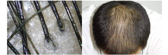 ���ϼ���-�Ř�ɽ����ϴ�l(f��)��