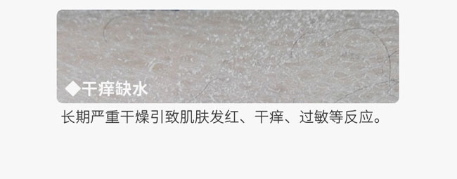 �C��ѩ�wõ�����ױ���Ħ��