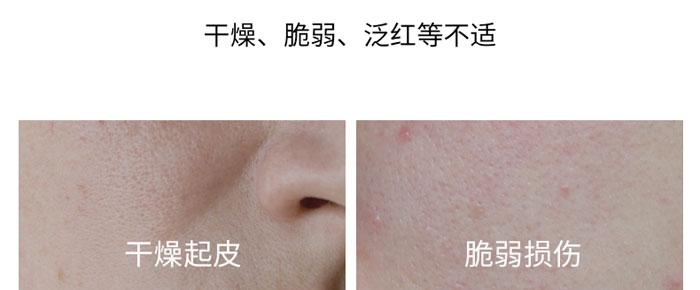 ���㷼����̥���F�D��